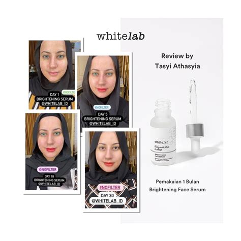 Whitelab N Dose Brightening Serum Niacinamide