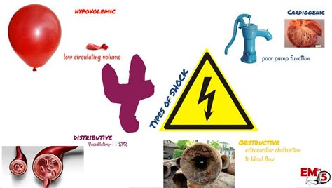 shock   types  shock em