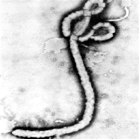 Virion Structure Of The Ebola Virus Scheme Shows The GP Spikes