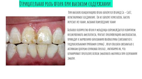 Пульпа - презентация онлайн