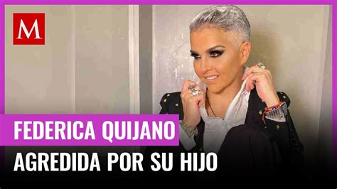 Qu Tiene El Hijo De Federica Quijano Ste Es El Padecimiento Que