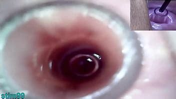 Lesbians Extreme Cervix Play And Peehole Fucking Penis Dildo Xvideos