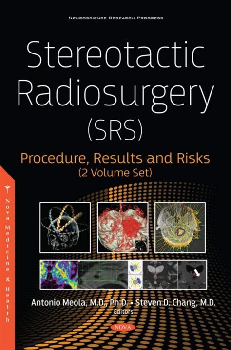 Stereotactic Radiosurgery Srs Procedure Results And Risks 2 Volume