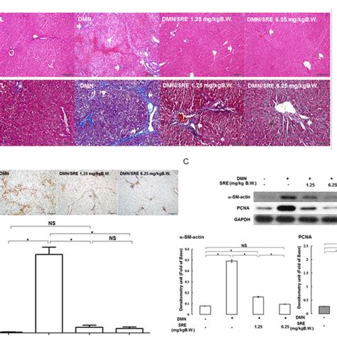 Schematic Diagram Of Dmn Mediated Liver Injury Through Downregulation