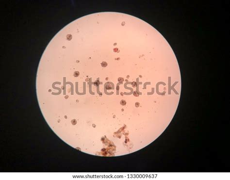 Closed Sarcoptic Mange Microscope Stock Photo 1330009637 | Shutterstock