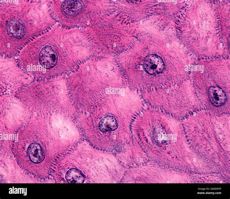 Human skin epidermis. Light micrograph of the stratum spinosum of the ...