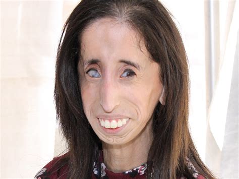 La activista Lizzie Velasquez pide que dejen de usar su rostro en un