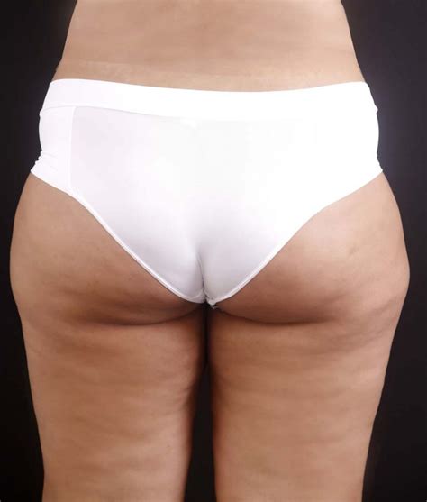 Calcinha Confort Vel De Pala Alta Loraza Bela Delicada Lingerie Conforto E Leveza Para A