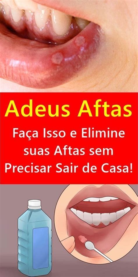 Como Curar Afta Na Gengiva Rápido - RECEITA CASEIRA PARA TRATAR AS AFTAS DA BOCA | Oral, Fitbit
