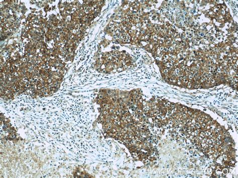 Cd44 Antibody 60224 1 Ig Proteintech