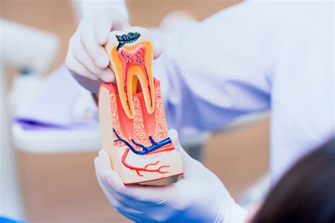 Symptoms Of Root Canal Infection A Comprehensive Guide