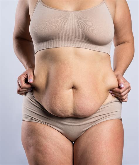 Excess Fat Treatments McLean Potomac Dermatology