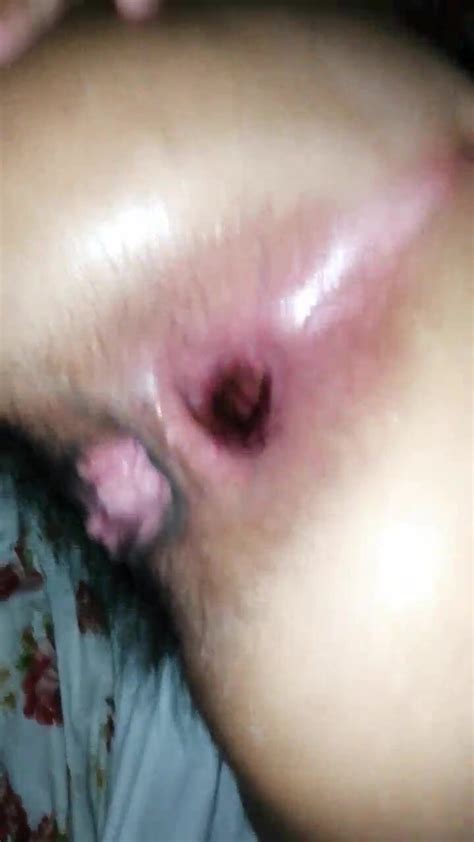 Anal Culo Abierto ThisVid