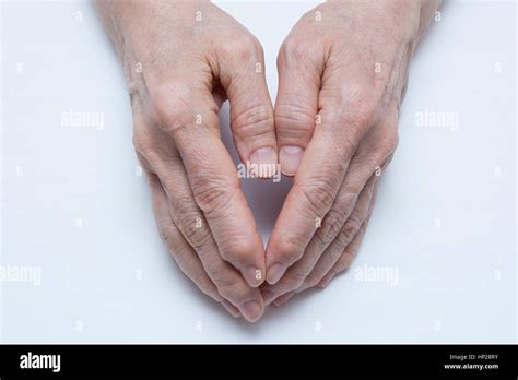 Osteoarthritis Hands And Fingers Of A Female Stock Photo Alamy