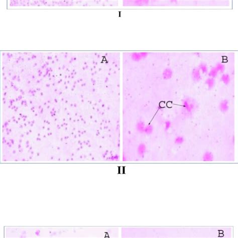 Different Stages Of Estrous Cycle Of Treated Cyclic Mice A X B