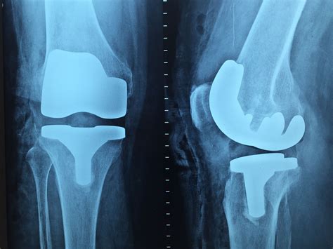 Orthopedic Wallpapers on WallpaperDog