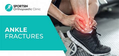 Ankle Fracture | SportsIn Orthopaedic Clinic | Dr Bernard Lee