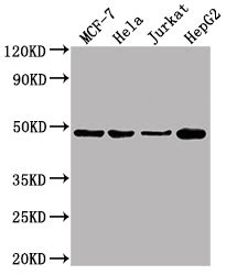 抗体 Mouse体内培养的Homo sapiens Human ENO1 Monoclonal Antibody 华美生物