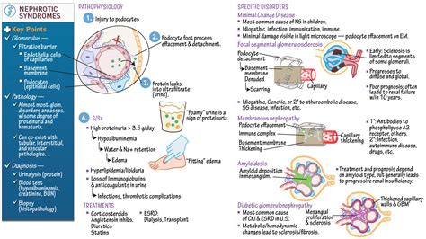 USMLE COMLEX Step 2 Nephrotic Syndrome Draw It To Know It