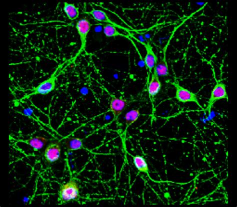 Mature Neuron Marker Antibody Panel IRAP5014 IReal Biotechnology Inc