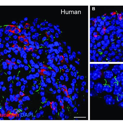 Detection Of Primary Cilia In Human And Mouse Islets By Download Scientific Diagram