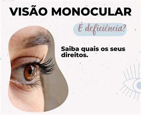 Visão Monocular é deficiência Saiba quais são os seus direitos