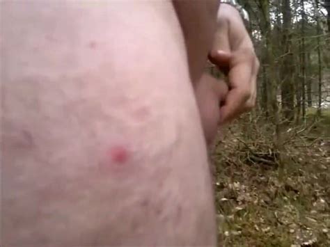 Dick Walking Iii Gay Outdoor Amateur Porn Xhamster