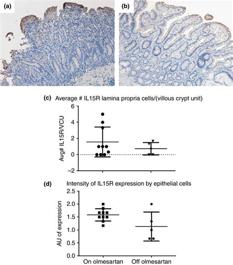 Il R Expression Distribution Duodenal Biopsies From A Representative