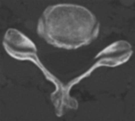 Accuracy Of Contrast Enhanced Mdct And Mri For Identifying The Severity