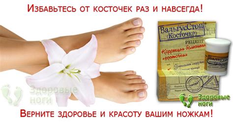 Купить крем ВальгусСтоп от косточки на большом пальце ноги. Мазь для ...