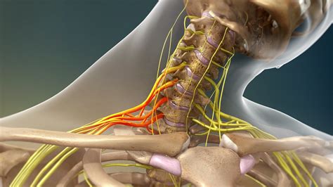 Brachial Plexus Injury Diagnosis And Treatment
