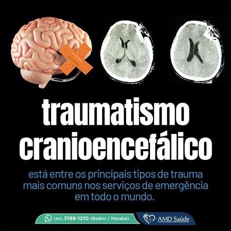 Traumatismo Cranioencef Lico Amd Sa De