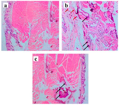 Nude Mice Teratoma Assay A Histochemical Analysis Showed The