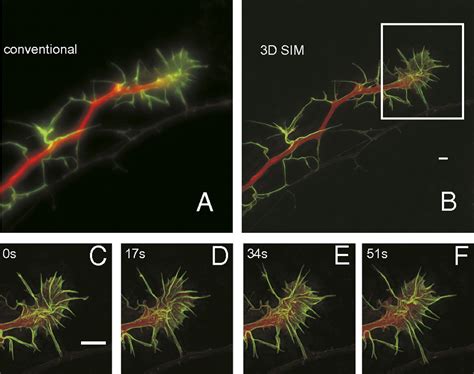 Time Lapse Two Color 3d Imaging Of Live Cells With Doubled Resolution Using Structured