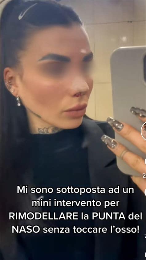 La Chirurgia Estetica Viaggia Sui Social Carica Di Influencer Che