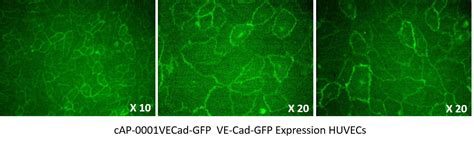 Human Umbilical Vein Endothelial Cells Huvecs Angio Proteomie