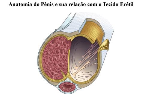 Doença De Peyronie Ou Curvatura Peniana Dr Paulo Rodrigues