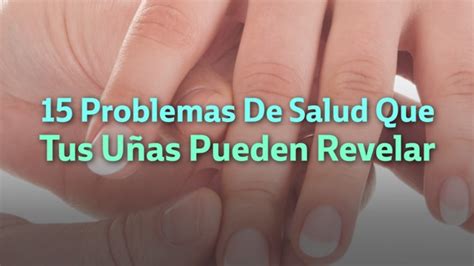 Problemas De Salud Que Tus U As Pueden Revelar