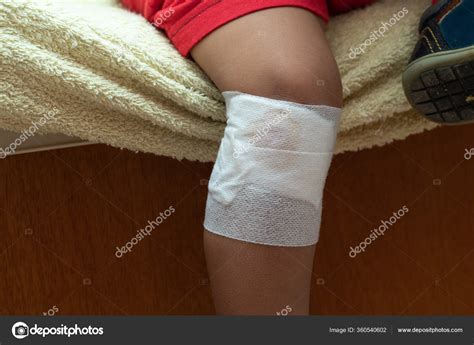 Grazed Knee Knee — Stock Photo © Sruilk 360540602