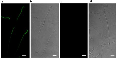 LF Binding To Rat Spermatozoa A Fluorescence Micrographs Of Rat Sperm