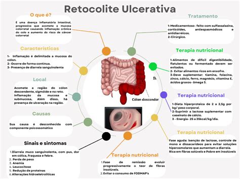 Sintomas Da Retocolite Ulcerativa - Mapa Mental: Retocolite Ulcerativa | PDF | Colite ulcerosa | Doenças e ...