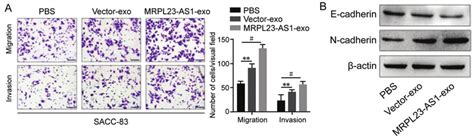 Mrpl As In Cell Derived Exosomes Promoted The Emt Of Sacc Cells