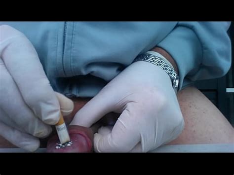 Videocompress Sigaretta Spenta Sul Glande Xvideos