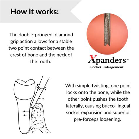 Dental Elevator Vs Periotome Which Is Better For Your Practice And Why