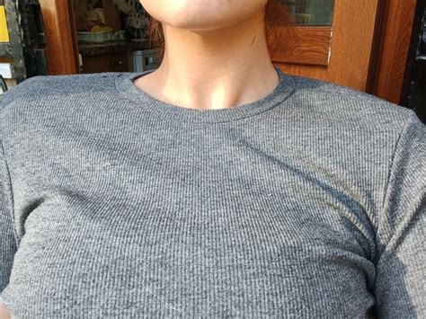 Omuzlar M Cok Genis Bikini Giymeye Utan Yorum Bunun Estetikle D Zelme Ihtimali Var M