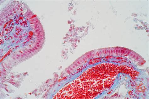 20 Myoepithelium Photos Stock Photos Pictures And Royalty Free Images