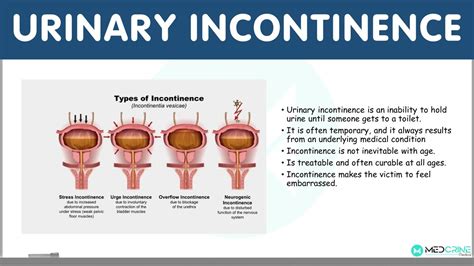 Urinary Incontinence: Definition, Types, Causes, Diagnosis and ...