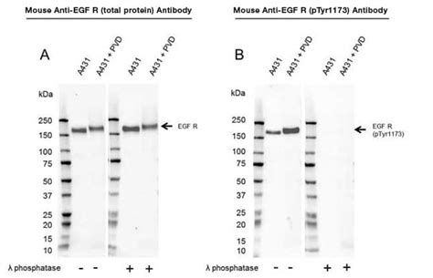 Biorad western blot protein ladder - guglindiana