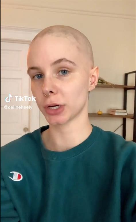 TikTokers show off hair growth after starting miracle alopecia drug ...