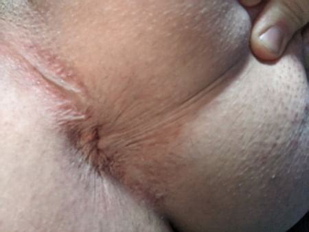 Ass Pictures 3 60 Pictures Of Beeing Your Fucktoy 60 Pics XHamster